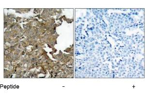 Image no. 1 for anti-Cofilin 1 (CFL1) (AA 1-5), (N-Term) antibody (ABIN197372) (Cofilin antibody  (N-Term))