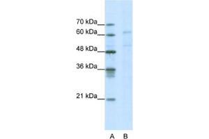 Western Blotting (WB) image for anti-Calcium Channel, Voltage-Dependent, beta 3 Subunit (CACNB3) antibody (ABIN2461082) (CACNB3 antibody)