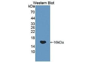 Western blot analysis of the recombinant protein. (GP1BB antibody  (AA 52-164))
