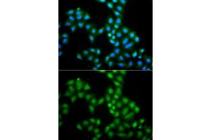 Immunofluorescence analysis of A549 cells using SAMHD1 antibody. (SAMHD1 antibody  (AA 387-626))
