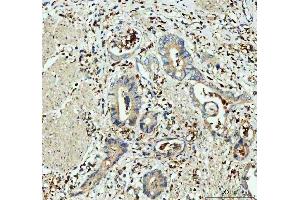 IHC analysis of GPX1 using anti-GPX1 antibody (ABIN3043834).