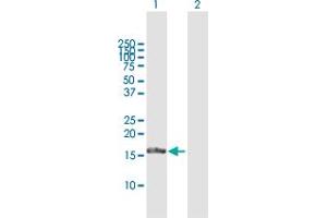 Western Blot analysis of FGF1 expression in transfected 293T cell line by FGF1 MaxPab polyclonal antibody. (FGF1 antibody  (AA 1-155))