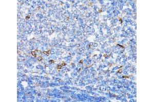 Immunohistochemistry of paraffin-embedded Rat spleen using NDE1 Polyclonal Antibody at dilution of 1:100 (40x lens).