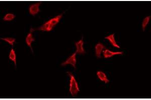 ABIN6272414 staining Hela by IF/ICC. (RHOG antibody  (Internal Region))