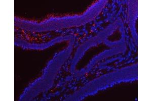 IF analysis of RRS1 using anti-RRS1 antibody (ABIN7602918). (RRS1 antibody  (C-Term))