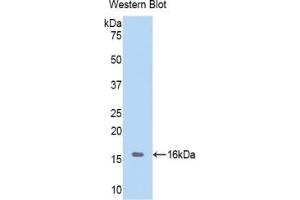 Detection of Recombinant Hemoglobin, Porcine using Polyclonal Antibody to Hemoglobin (HB) (Hemoglobin antibody)