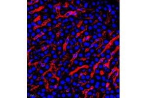 Immunofluorescence (Paraffin-embedded Sections) (IF (p)) image for anti-alpha-2-HS-Glycoprotein (AHSG) antibody (ABIN7073021)