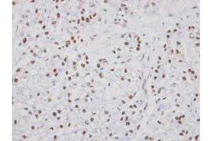 IHC-P Image Immunohistochemical analysis of paraffin-embedded human oral tissue, using PUF60, antibody at 1:100 dilution. (PUF60 antibody  (C-Term))