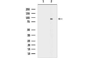 anti-Interleukin 4 Receptor (IL4R) antibody