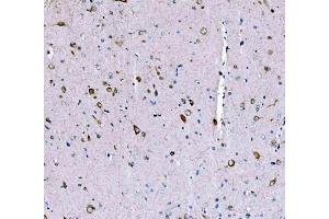 IHC analysis of SCRN1 using anti-SCRN1 antibody (ABIN7602923). (Secernin 1 antibody  (C-Term))