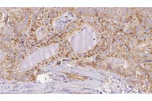 anti-ATG14 Autophagy Related 14 (ATG14) (pSer29) antibody