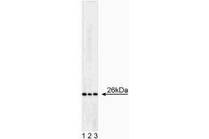 Western blot analysis of Bcl-2. (Bcl-2 antibody)