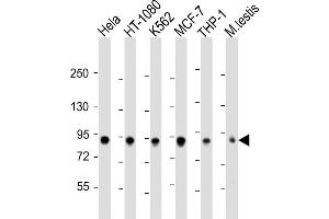 All lanes : Anti-TBK1 Antibody  at 1:2000 dilution Lane 1: Hela whole cell lysate Lane 2: HT-1080 whole cell lysate Lane 3: K562 whole cell lysate Lane 4: MCF-7 whole cell lysate Lane 5: THP-1 whole cell lysate Lane 6: mouse testis lysate Lysates/proteins at 20 μg per lane. (TBK1 antibody  (AA 150-181))