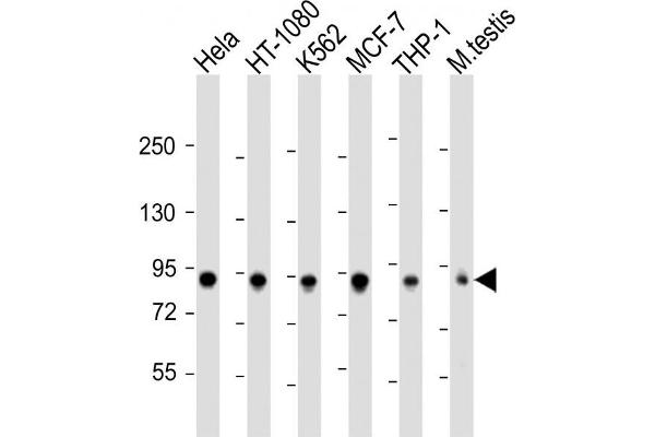 TBK1 Antikörper  (AA 150-181)