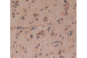 Used in DAB staining on fromalin fixed paraffin- embedded Kidney tissue (14-3-3 theta antibody  (AA 1-241))