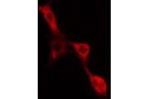 ABIN6277567 staining NIH-3T3 cells by IF/ICC. (EIF4B antibody  (Internal Region))