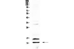 Western blot analysis of PF4 using anti-PF4 antibody . (PF4 antibody  (AA 30-105))