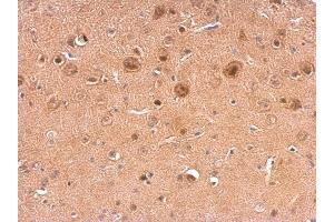 IHC-P Image NCS1 antibody detects NCS1 protein at on mouse fore brain by immunohistochemical analysis. (NCS1 antibody)