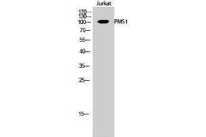 Western Blotting (WB) image for anti-PMS1 Postmeiotic Segregation Increased 1 (S. Cerevisiae) (PMS1) (Internal Region) antibody (ABIN3186512) (PMS1 antibody  (Internal Region))
