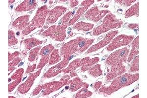 Human Heart (formalin-fixed, paraffin-embedded) stained with CPT1Aat 4 µg/ml followed by biotinylated anti-goat IgG secondary antibody, alkaline phosphatase-streptavidin and chromogen. (CPT1A antibody  (Internal Region))