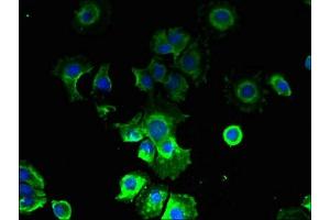 Immunofluorescent analysis of MCF-7 cells using ABIN7146656 at dilution of 1:100 and Alexa Fluor 488-congugated AffiniPure Goat Anti-Rabbit IgG(H+L) (CMTR2 antibody  (AA 301-600))