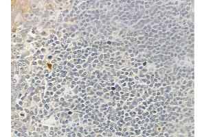 ABIN6262555 and ABIN6276764 at 1/100 staining human normal tonsil tissue by IHC-P.