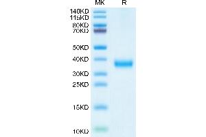 SARS-CoV-2 Spike RBD (Delta plus AY. (SARS-CoV-2 Spike Protein (B.1.617.2 - delta plus, RBD) (His tag))