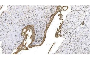IHC analysis of WEE1 using anti-WEE1 antibody (ABIN6719614). (WEE1 antibody)