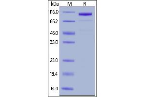 LRP5 Protein (AA 644-1263) (Fc Tag)