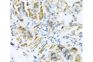 Immunohistochemistry of paraffin-embedded Mouse lung using VAMP1 Polyclonal Antibody at dilution of 1:100 (40x lens). (VAMP1 antibody)