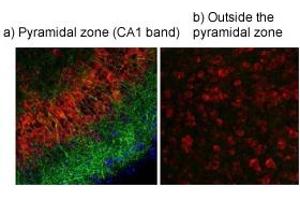 TRPV4 Rat Hippocampus We tested the antibodies in Immunohistochemistry studies. (TRPV4 antibody  (Middle Region))