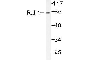 Image no. 1 for anti-V-Raf-1 Murine Leukemia Viral Oncogene Homolog 1 (RAF1) antibody (ABIN271798) (RAF1 antibody)
