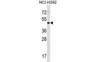 Western Blotting (WB) image for anti-Cytohesin 4 (CYTH4) antibody (ABIN2998789)
