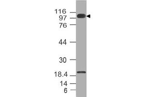 Image no. 1 for anti-Furin (Paired Basic Amino Acid Cleaving Enzyme) (FURIN) (AA 602-791) antibody (ABIN5027211) (FURIN antibody  (AA 602-791))
