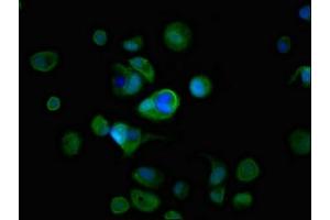 Immunofluorescent analysis of MCF-7 cells using ABIN7167322 at dilution of 1:100 and Alexa Fluor 488-congugated AffiniPure Goat Anti-Rabbit IgG(H+L) (RAB3A antibody  (AA 1-220))