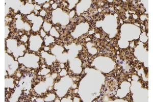 ABIN6257902 and ABIN6274337 at 1/100 staining Mouse lung tissue by IHC-P. (IB2 antibody  (Internal Region))