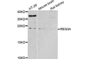 Western blot analysis of extracts of various cell lines, using REG3A antibody. (REG3A antibody)