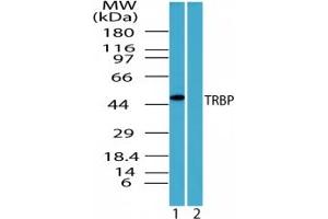 Image no. 3 for anti-TAR (HIV-1) RNA Binding Protein 2 (TARBP2) (AA 340-390) antibody (ABIN207742) (TARBP2 antibody  (AA 340-390))