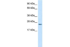 WB Suggested Anti-FADD Antibody Titration:  0. (FADD antibody  (C-Term))