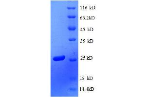 30S Ribosomal Protein S4 (AA 2-206), (full length) protein (His tag)