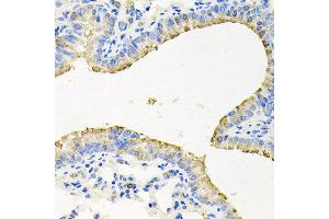 Immunohistochemistry of paraffin-embedded mouse lung using STRN3 antibody at dilution of 1:100 (x40 lens). (STRN3 antibody)