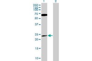 Western Blot analysis of PPP1CB expression in transfected 293T cell line by PPP1CB MaxPab polyclonal antibody. (PPP1CB antibody  (AA 1-327))