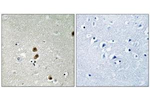 Immunohistochemical analysis of paraffin-embedded human brain tissue, using CtBP1 (Phospho-Ser422) antibody (left)or the same antibody preincubated with blocking peptide (right). (CTBP1 antibody  (pSer422))