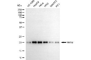 Western blotting analysis using NRAS antibody (ABIN7798817).