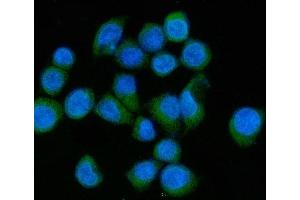 IF analysis of MLX-interacting protein/MLXIP using anti-MLX-interacting protein/MLXIP antibody (ABIN7602593). (MLXIP antibody  (AA 88-348))