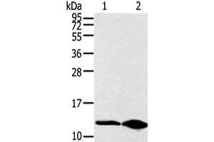 Western blot analysis of Hela cell and human fetal brain tissue using DYNLL2 Polyclonal Antibody at dilution of 1:250 (DYNLL2 antibody)