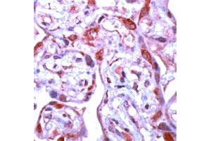 Immunohistochemical staining of human placenta stained with MMP1 polyclonal antibody  at 1 : 100 for 10 min at RT. (MMP1 antibody  (C-Term))