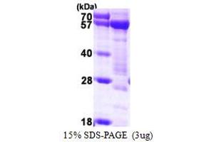 SDS-PAGE (SDS) image for Syntrophin, alpha 1 (Dystrophin-Associated Protein A1, 59kDa, Acidic Component) (SNTA1) (AA 1-505) protein (His tag) (ABIN7279671)