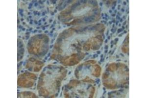 Used in DAB staining on fromalin fixed paraffin- embedded Kidney tissue (NUAK1 antibody  (AA 421-658))