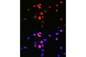 Immunofluorescence analysis of RD cells using MyoD1 Rabbit pAb (ABIN7268736) at dilution of 1:100 (40x lens). (MYOD1 antibody  (AA 150-250))